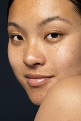 smiley-woman-with-acne-posing_149461.jpg
